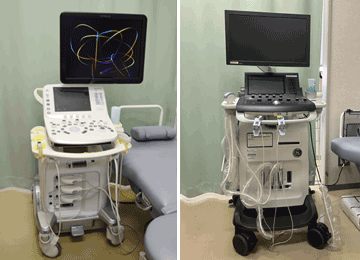超音波診断装置（心臓エコー、腹部エコー）